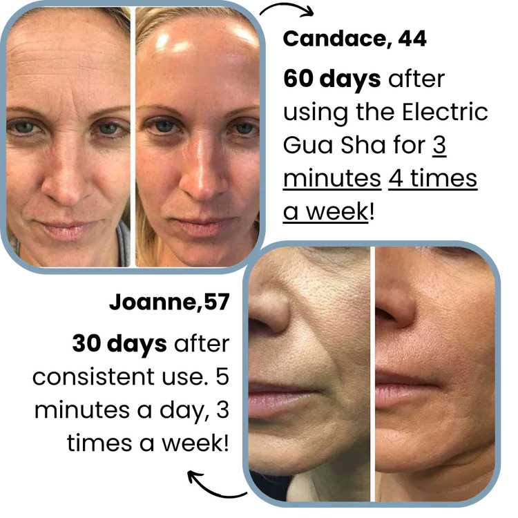 4-in-1 Electric Gua Sha - Image 3