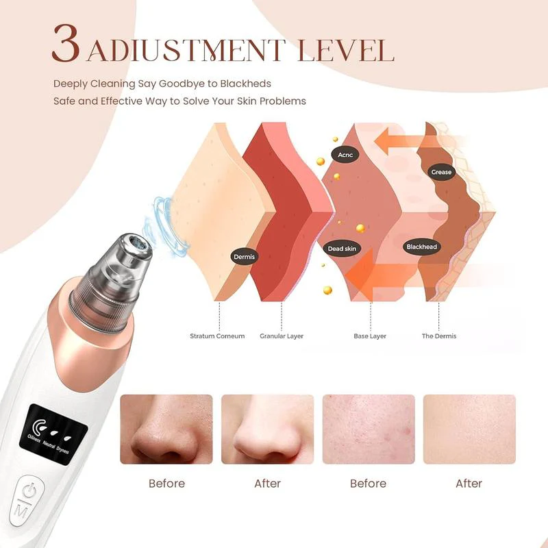 Blackhead Remover Pore Vacuum - Image 5