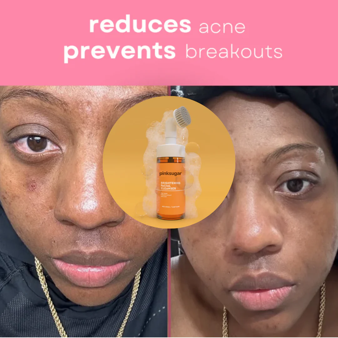 Brightening Foaming Face Wash - Image 2