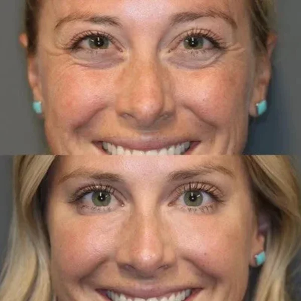Instant Under Eye Tightening Cream - Image 2
