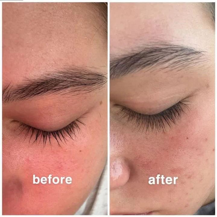 LashRX Eyelash Serum - Image 4
