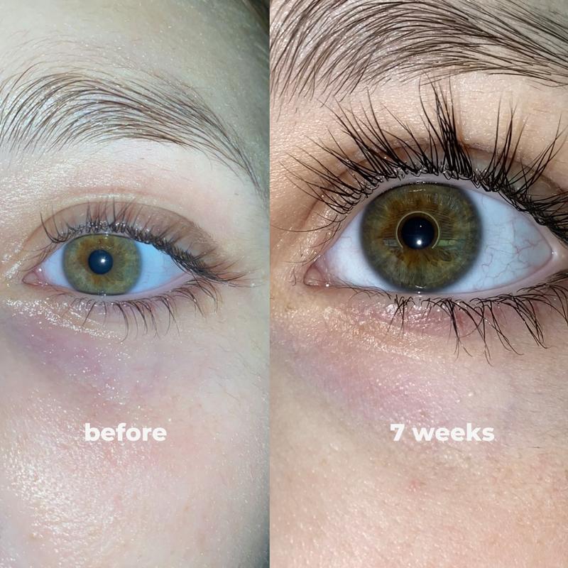 LashRX Eyelash Serum - Image 5