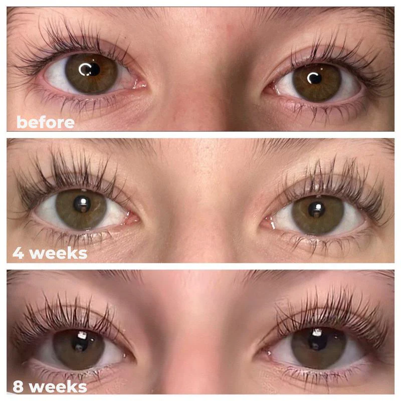 LashRX Eyelash Serum - Image 6
