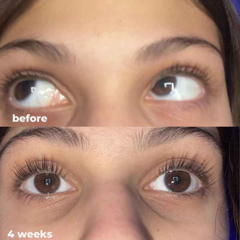 LashRX Eyelash Serum - Image 7