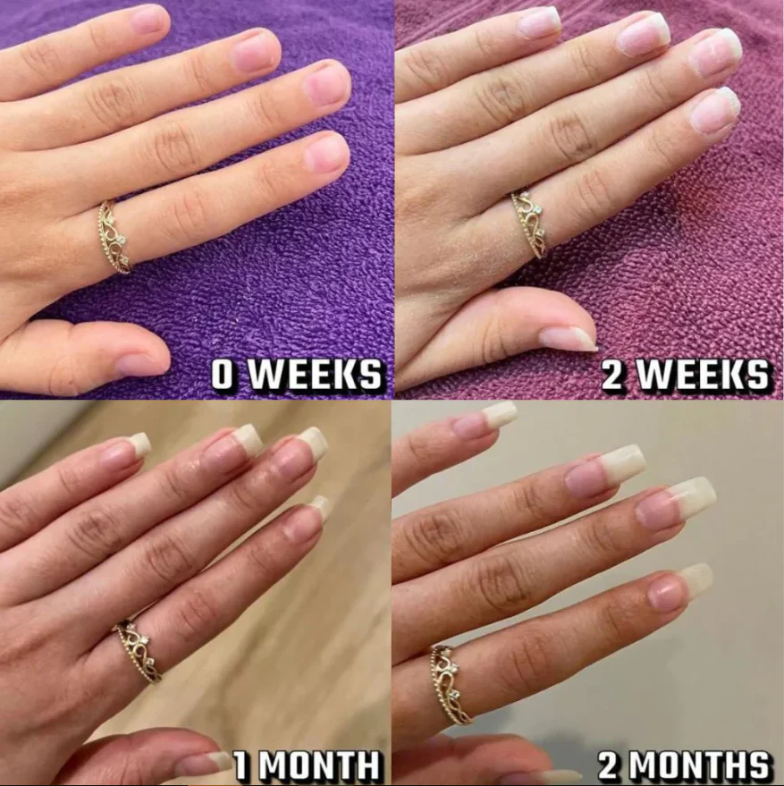 Nail Growth Pen - Image 3