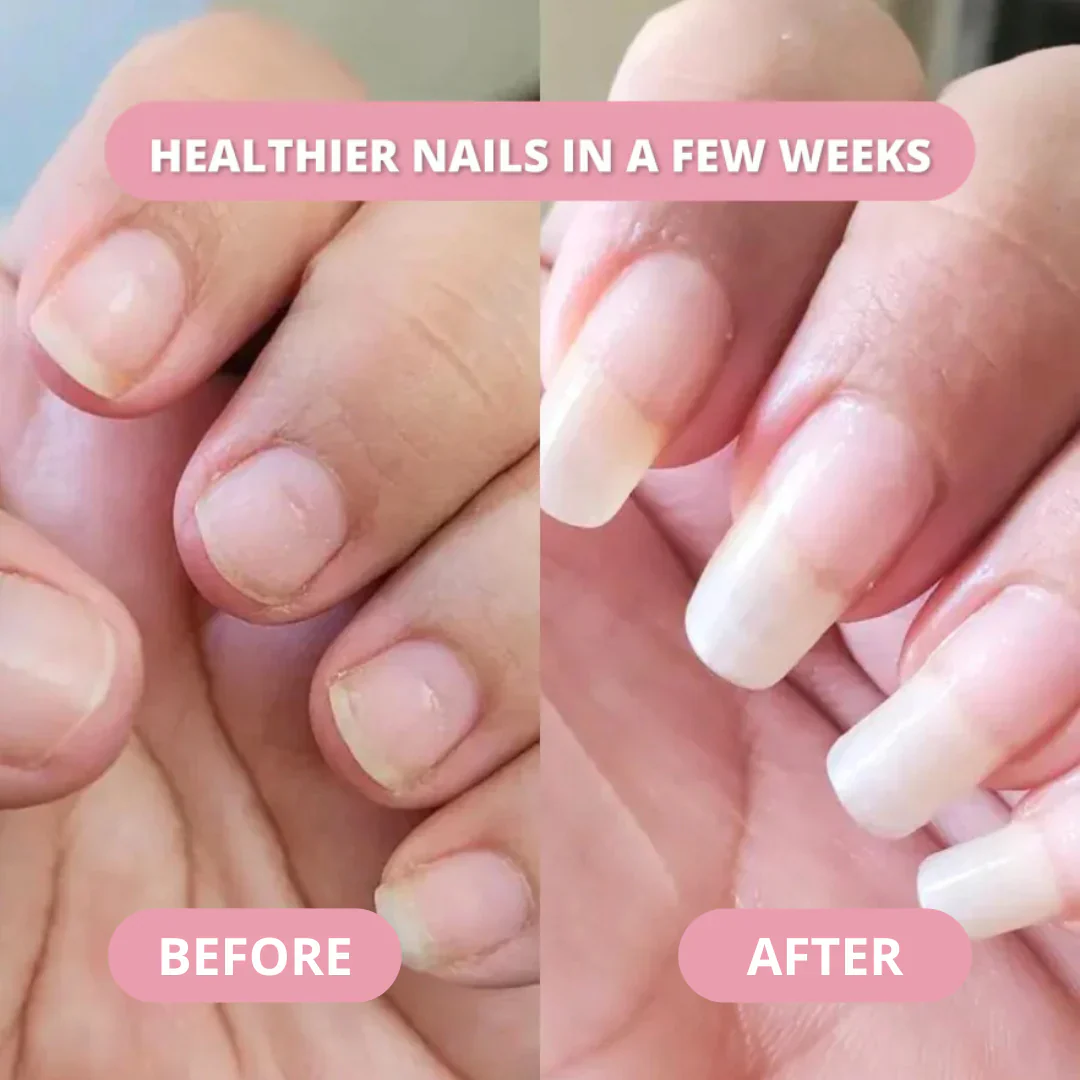 Nail Growth Pen - Image 4