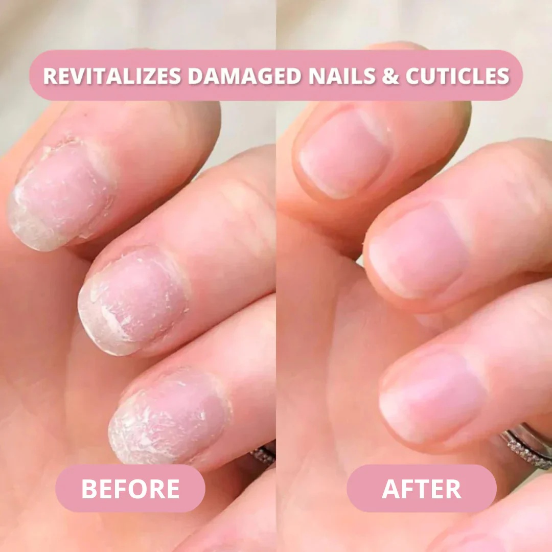 Nail Growth Pen - Image 5