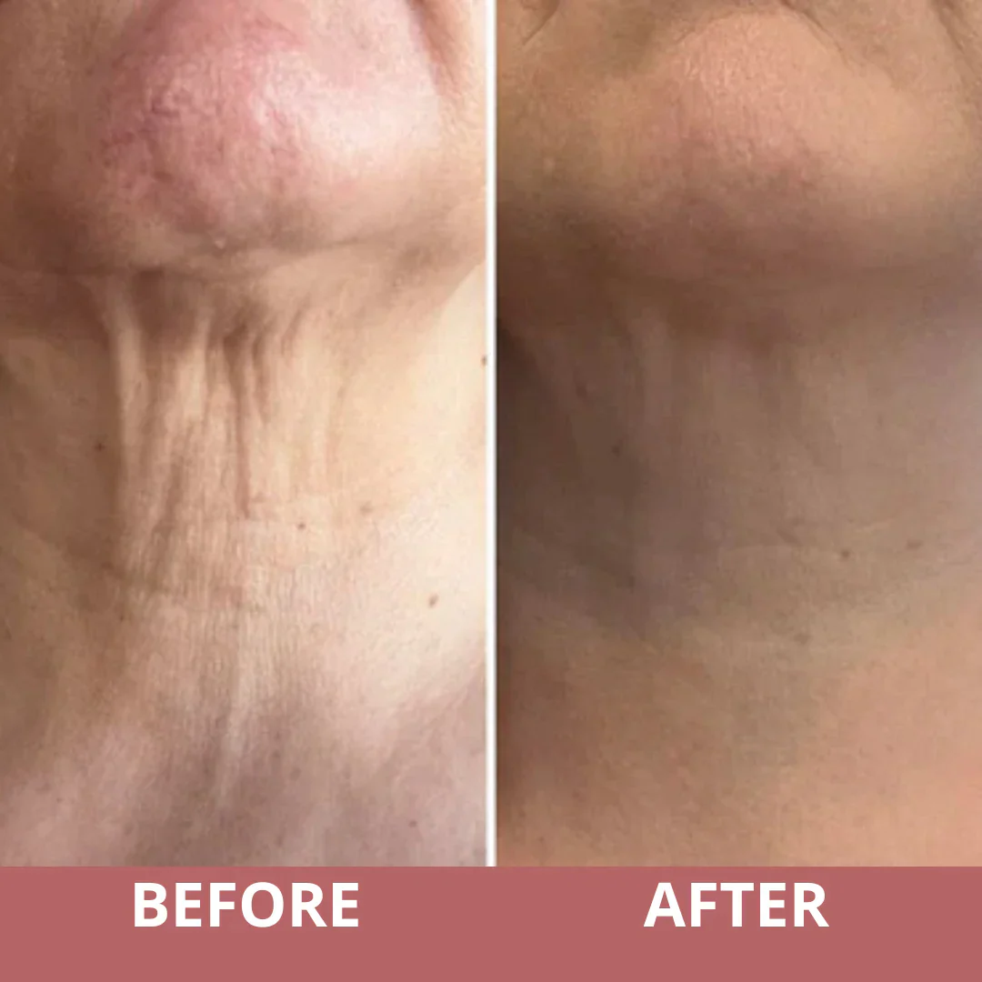 Tighten & Life Neck Cream by PinkSugar - Image 6