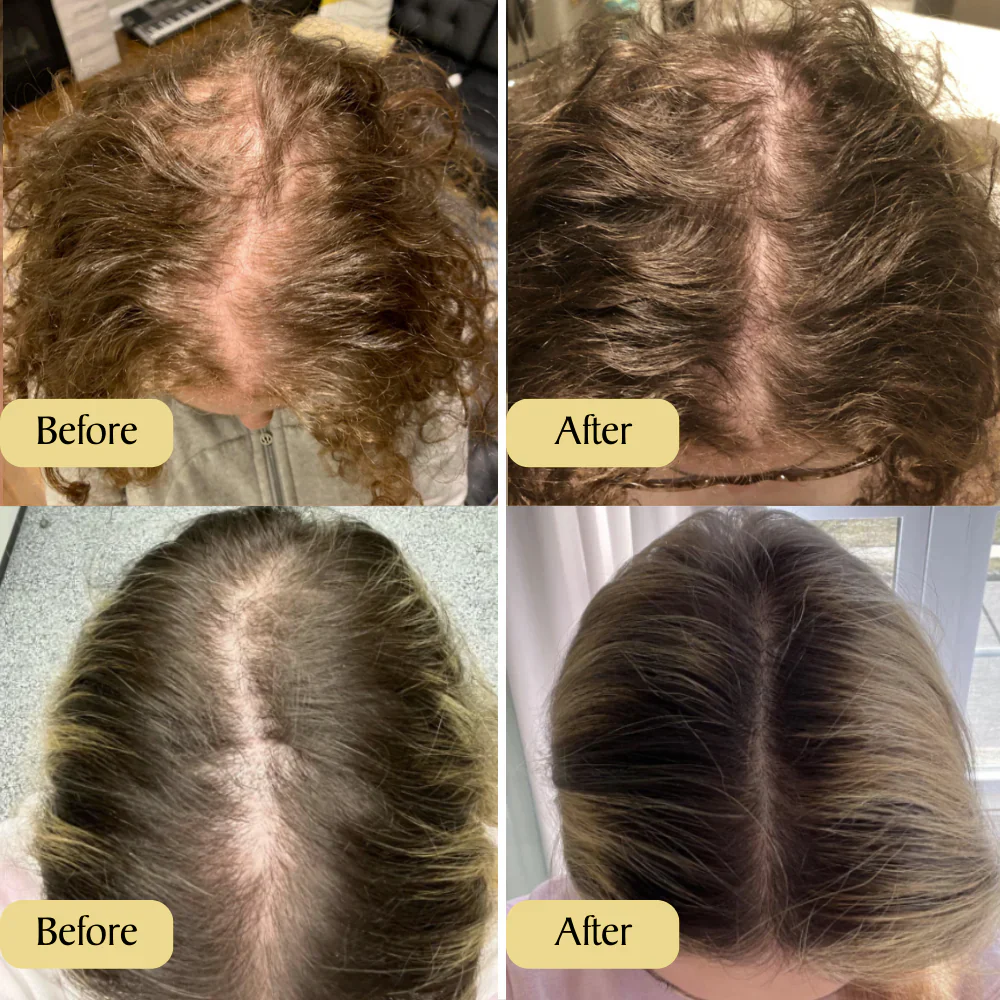 Vegan Hair Growth Oil - Image 4